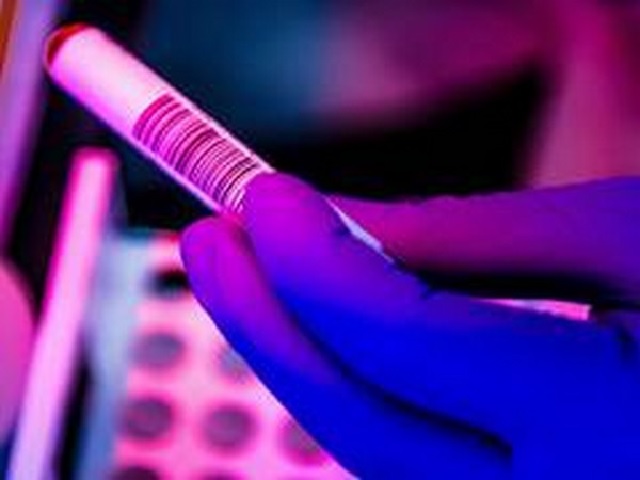 KGMU to launch Plasma Therapy