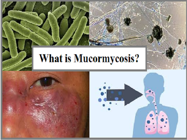Mucormycosis symptoms
