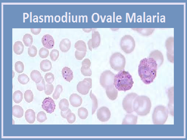 Plasmodium Ovale Malaria