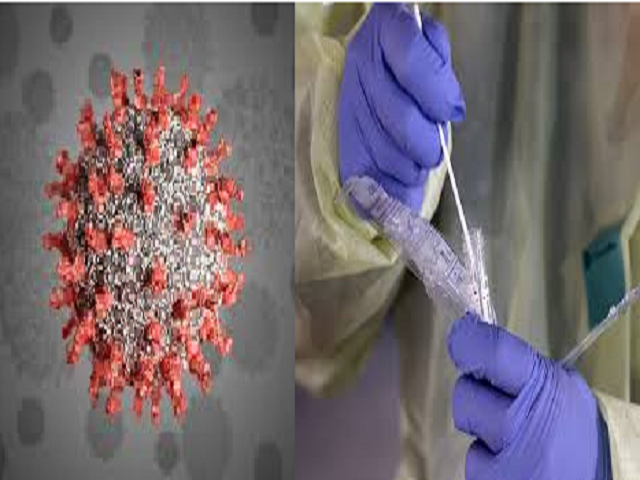 Do you know about the rapid antigen detection test for COVID-19? 