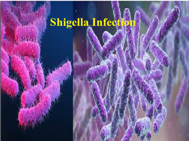 Shigella Infection
