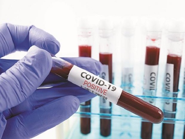 First case of COVID-19 re-infection reported in Bengaluru, 27 year-old woman tests positive again