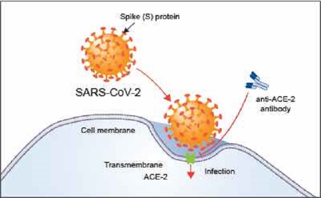 COVID-19 infection
