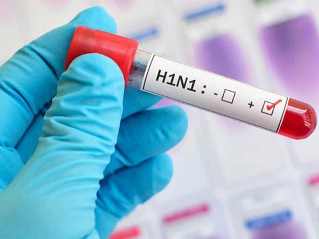 इनफ्लुएंजा वायरस (H1N1) या स्वाइन फ्लू क्या होता है और इसके क्या लक्षण होते हैं?