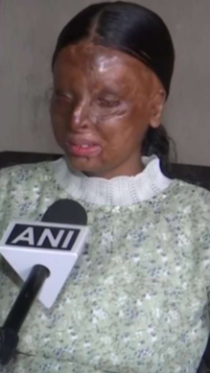 एसिड अटैक सर्वाइवर ने 10वीं की परीक्षा में 95.20% के साथ  किया टॉप